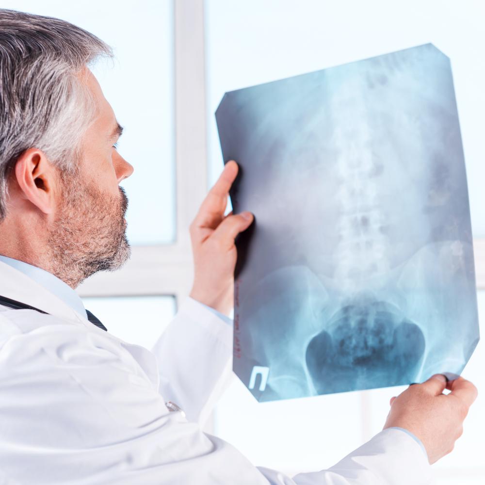 Specialized Rehabilitation Programs