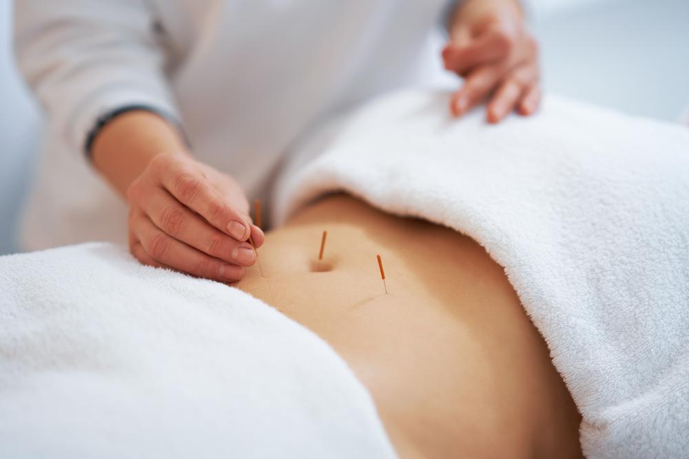 Patient Experiences at Woodbury Acupuncture