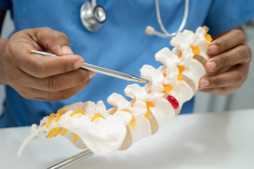 Integrated Treatment Approaches for Herniated Discs