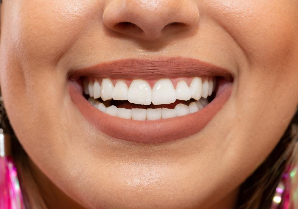 What Qualifies as a Teeth Whitening Near Me Emergency?