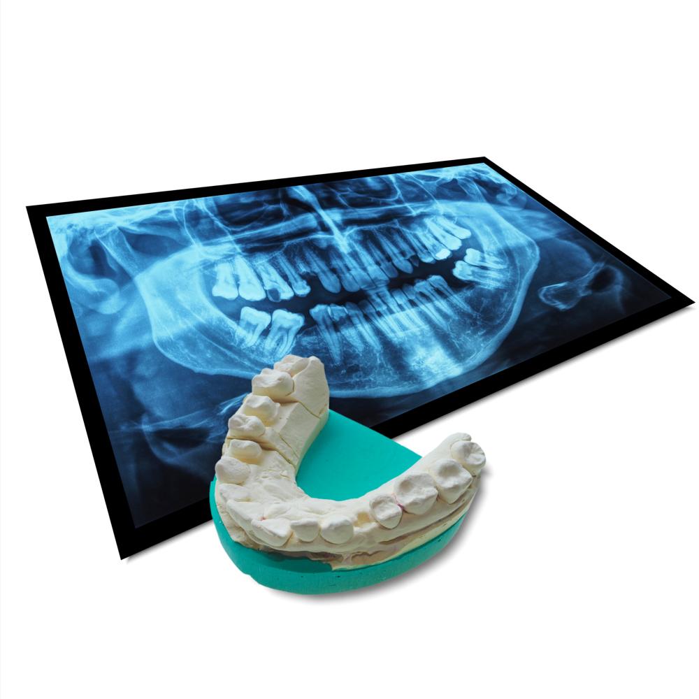 X-ray image illustrating dental health and technology