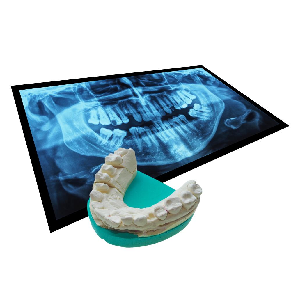 Comprehensive dental x-ray for better treatment planning post-extraction