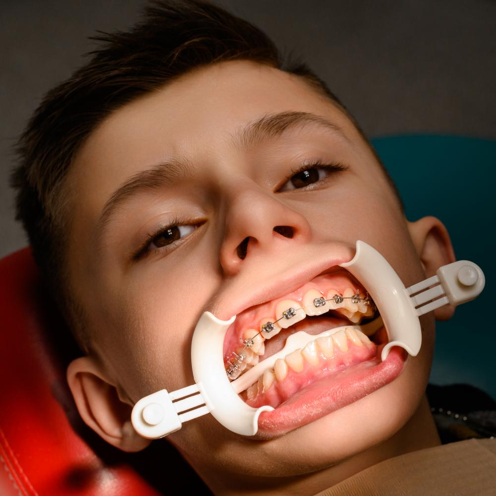 Leveraging Advanced Technology for Orthodontic Excellence