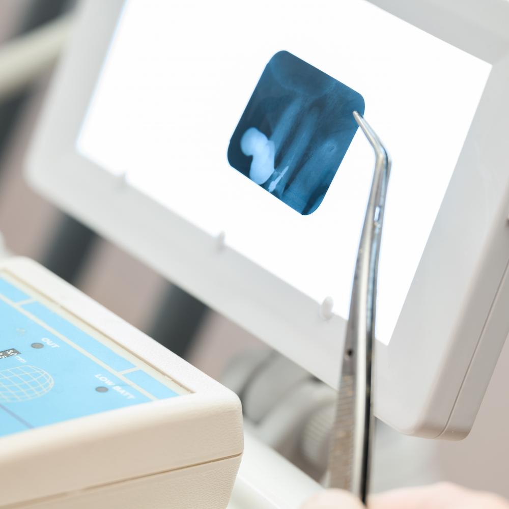Advanced dental technology facilitating same-day tooth extraction
