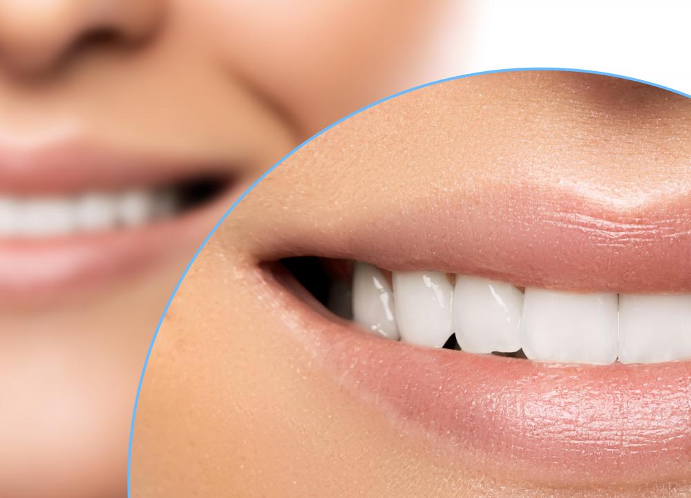 What Qualifies as a Cosmetic Dentist Melbourne Emergency?