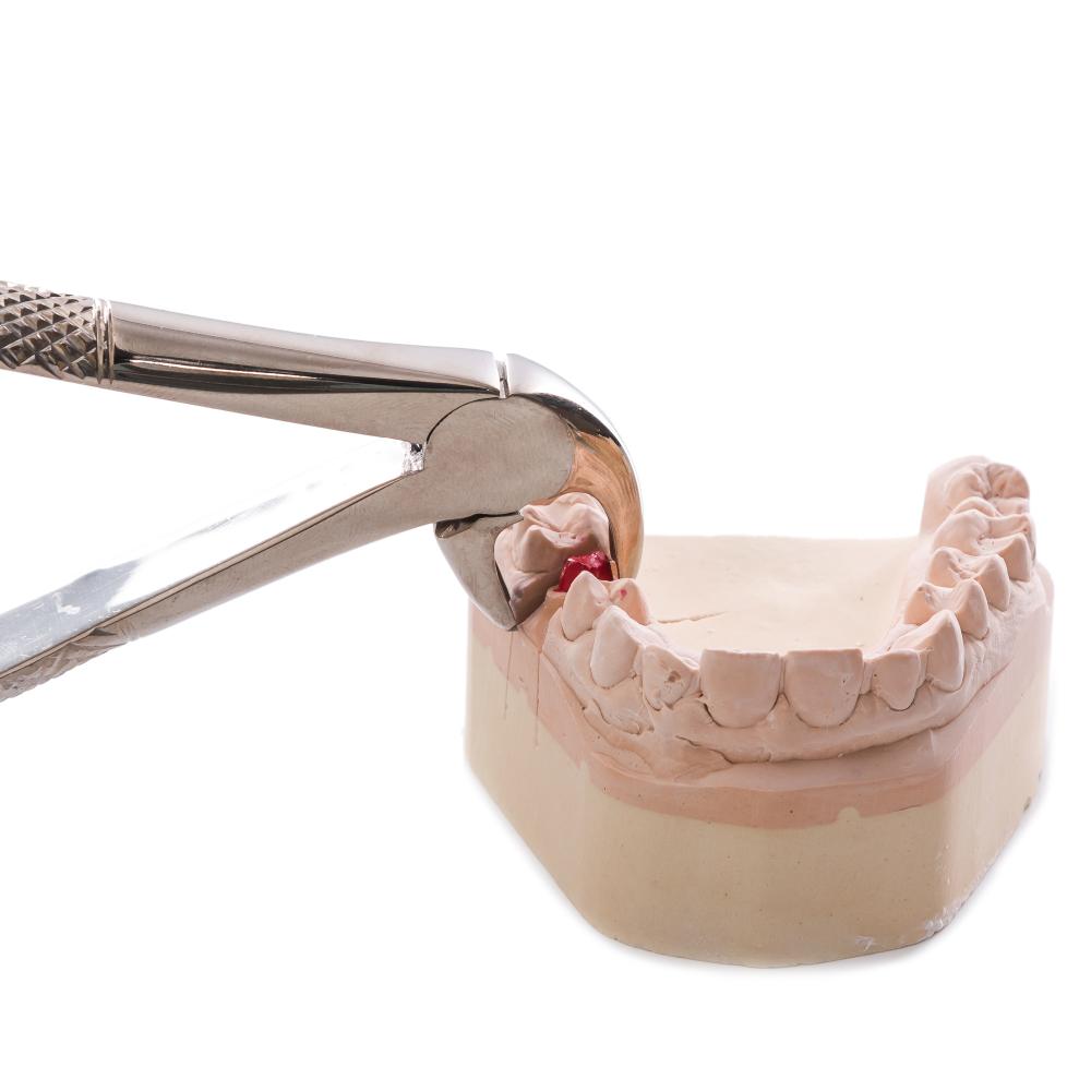 Expert Dental Care and Tooth Extraction Recovery