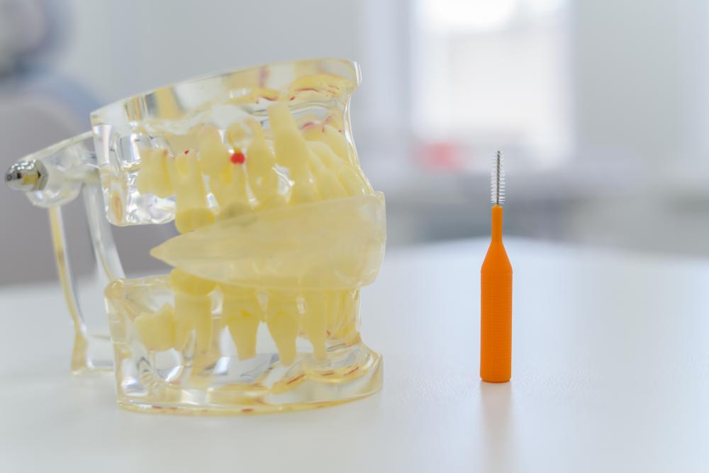 Clear dental model illustrating potential for Same-Day Dental Extraction