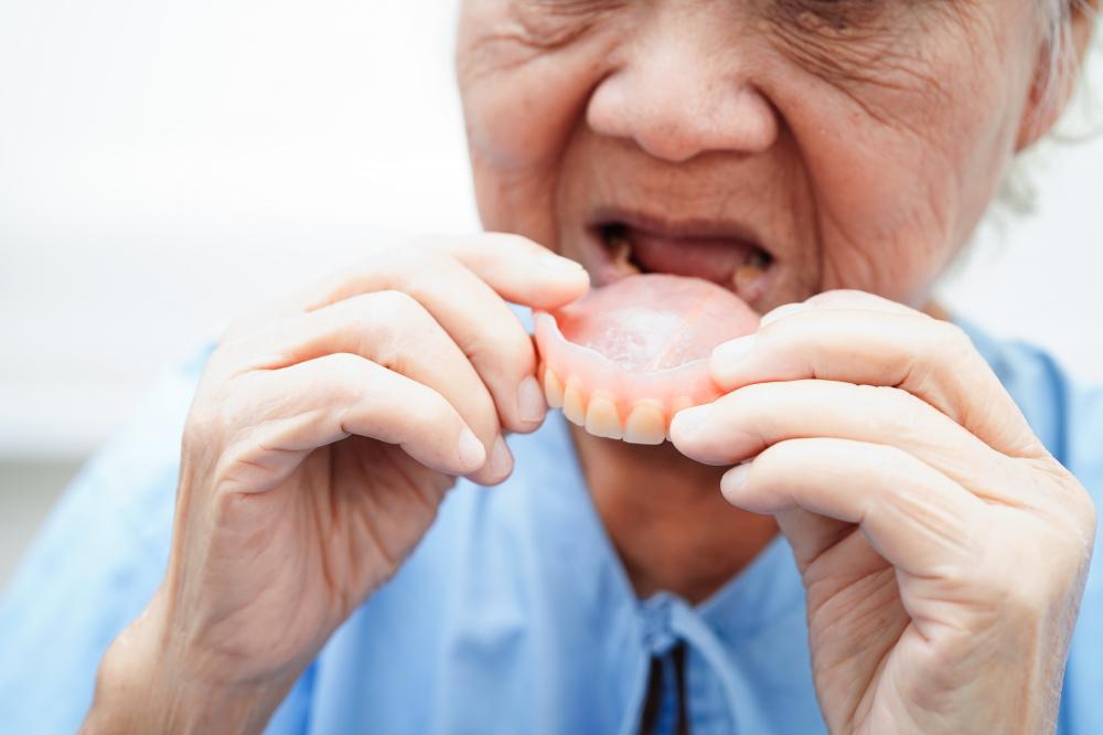 Asian senior patient trying on dentures in Jupiter, FL dental clinic