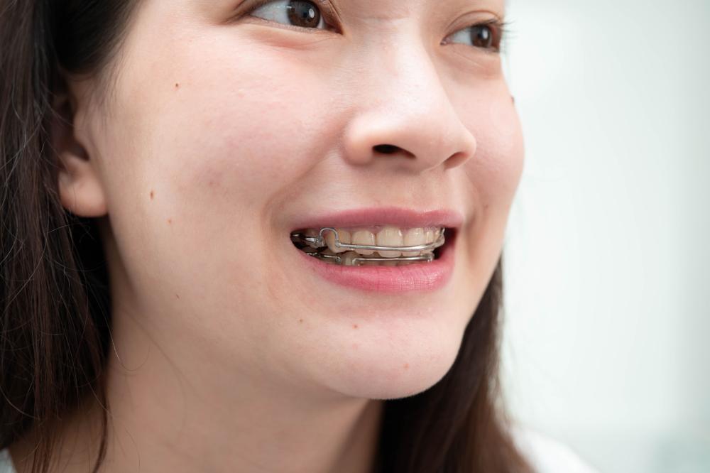 Why Choose Adult Orthodontics?