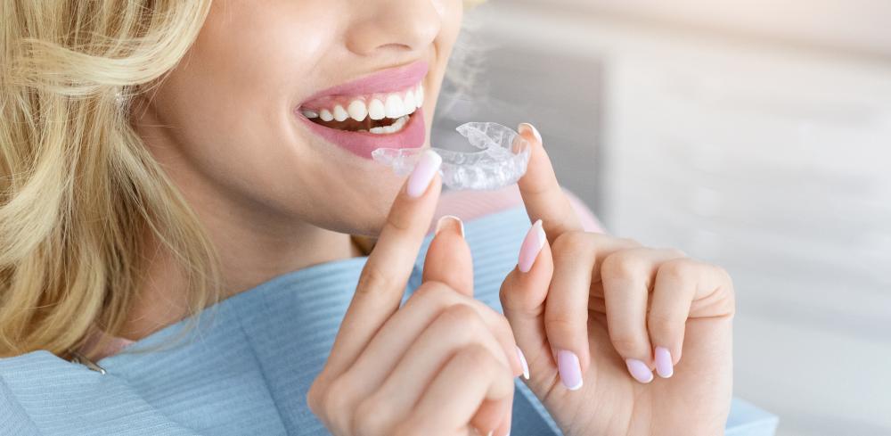 The Benefits of Invisalign White Rock