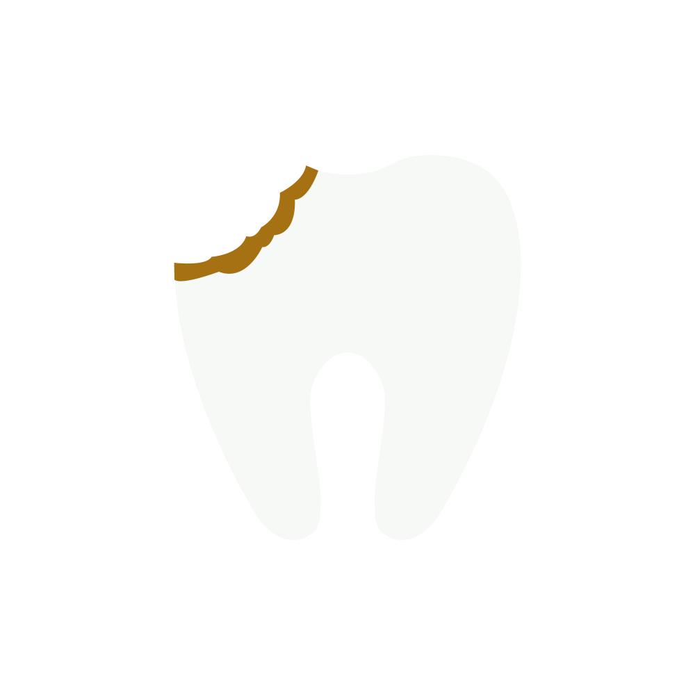 Dental care for broken teeth and cavities