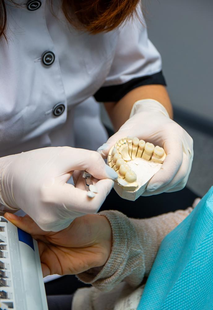 What Types of Dental Bridges are Available?