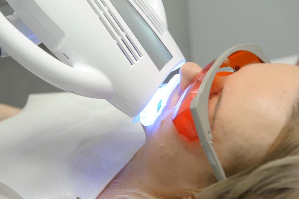 Benefits of Professional Whitening