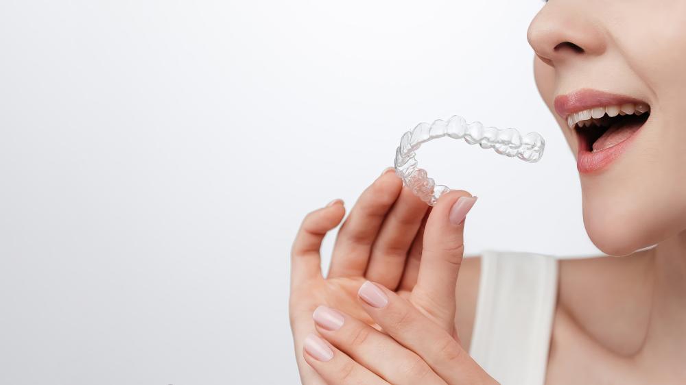 Benefits and Features of Invisalign White Rock