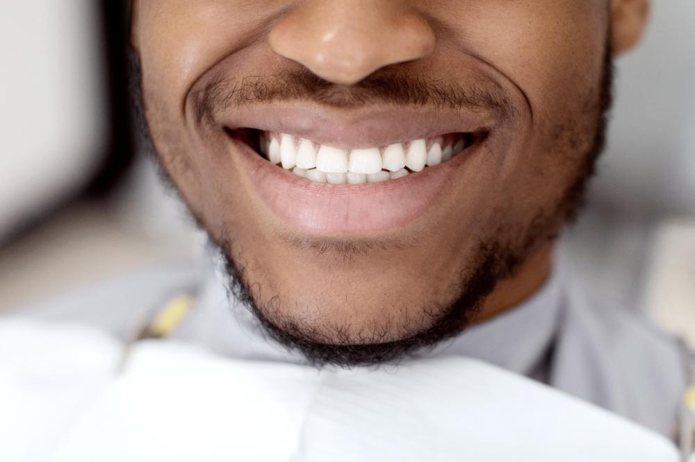 Qualities of a Reliable Cosmetic Dentist