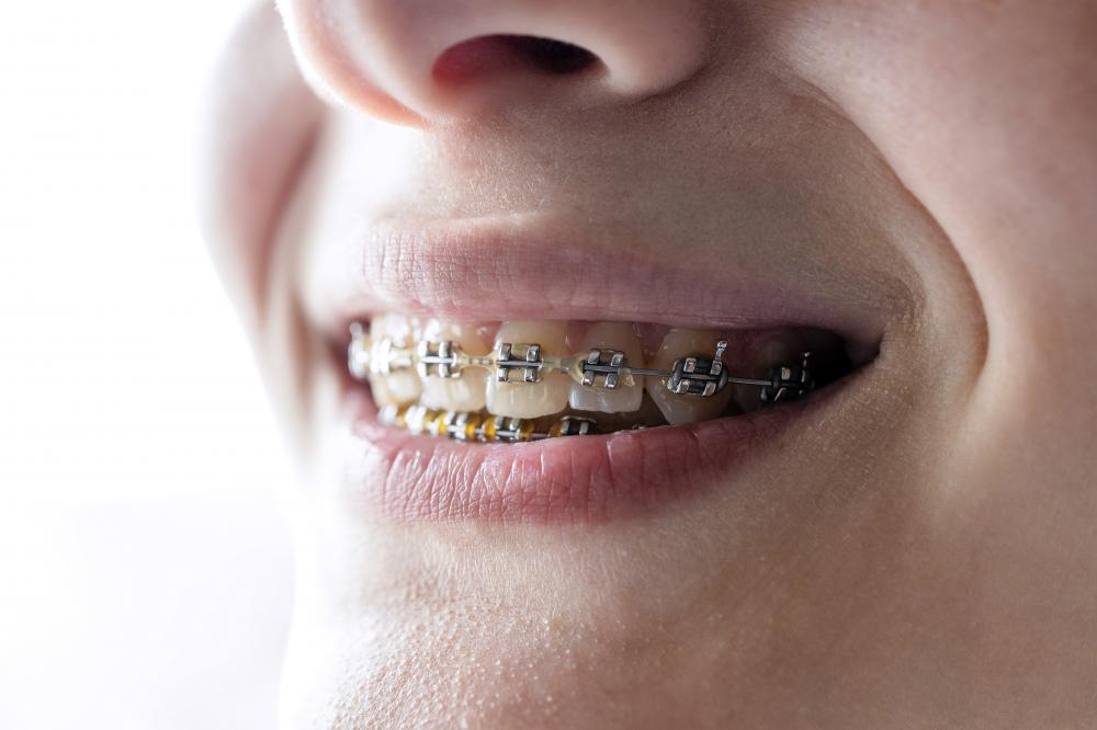 Modern orthodontic clinic in Mesa, AZ featuring advanced technology for braces treatment