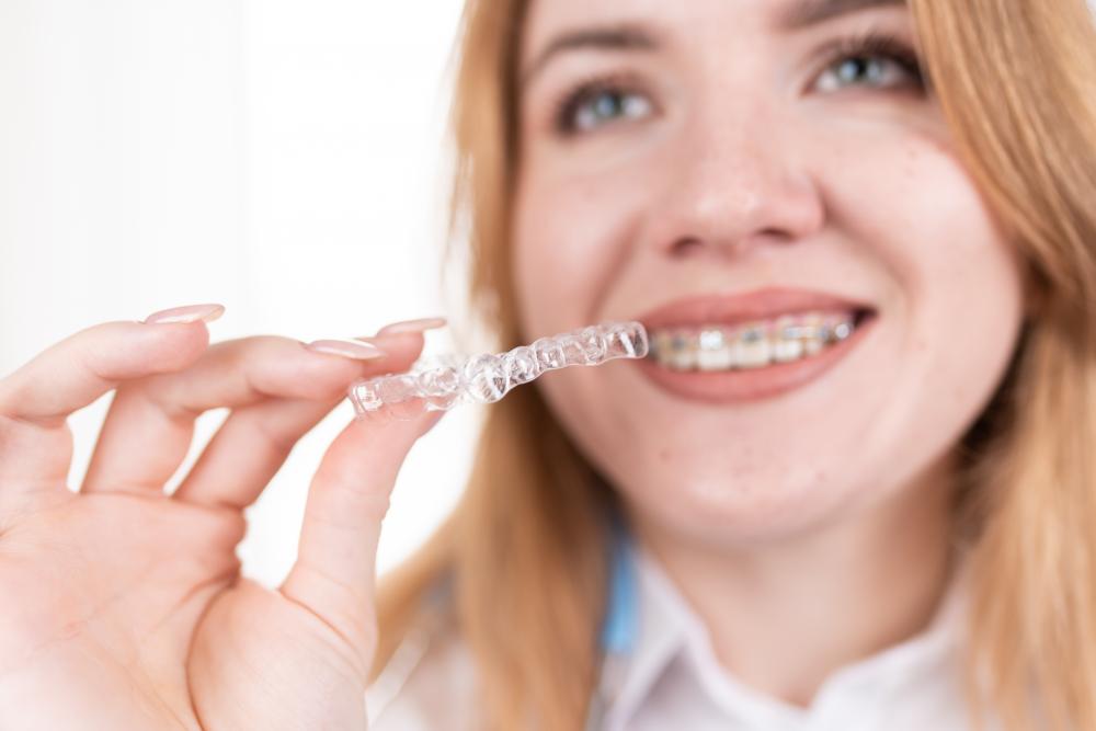 Advantages of Invisalign Treatment