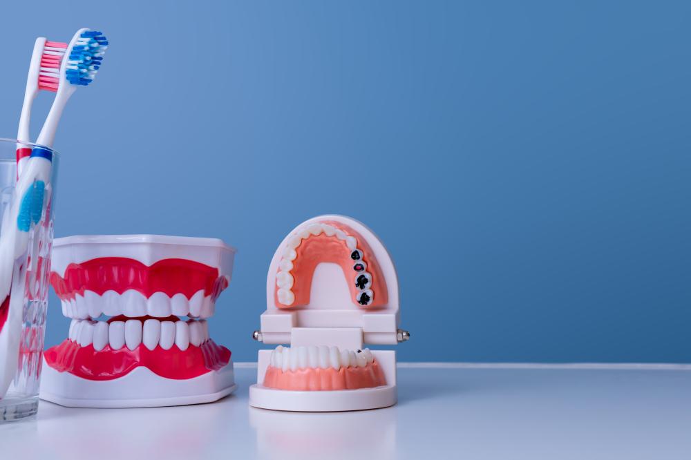 Why Choose The Grove Dentistry for Dental Bridges Port Coquitlam?