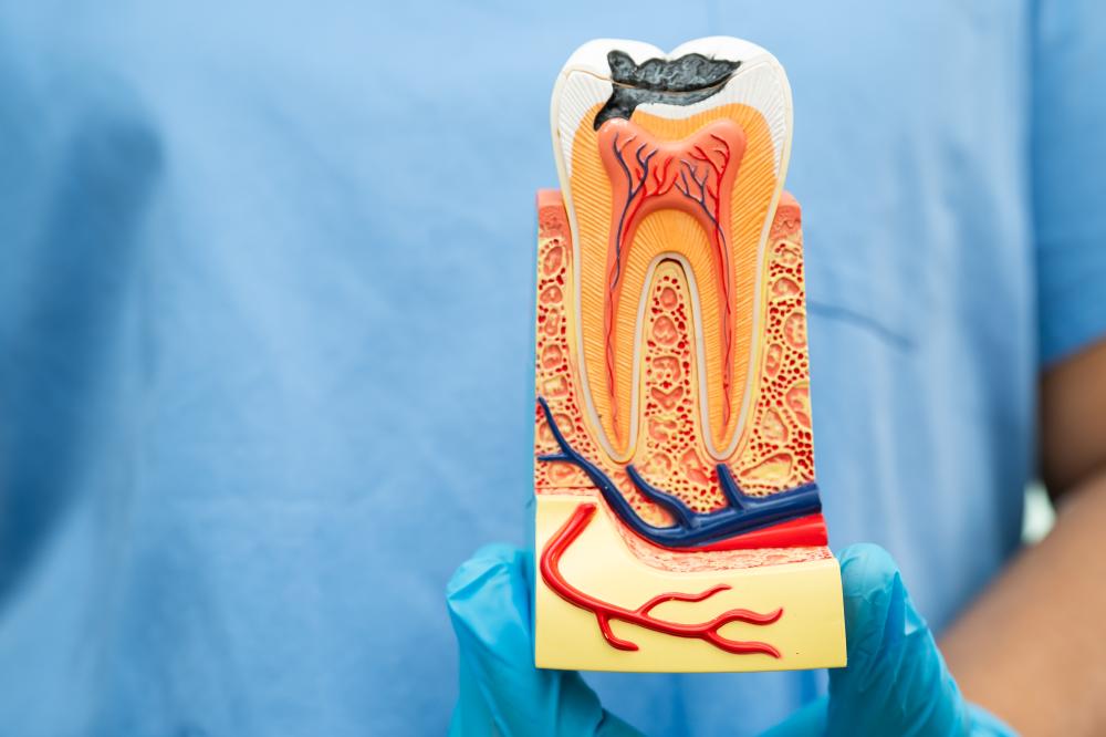 Signs and Symptoms of Needing a Root Canal