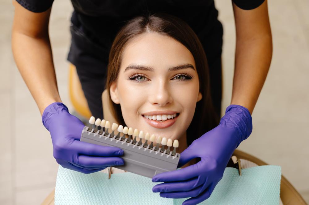 Why Choose Professional Teeth Whitening?