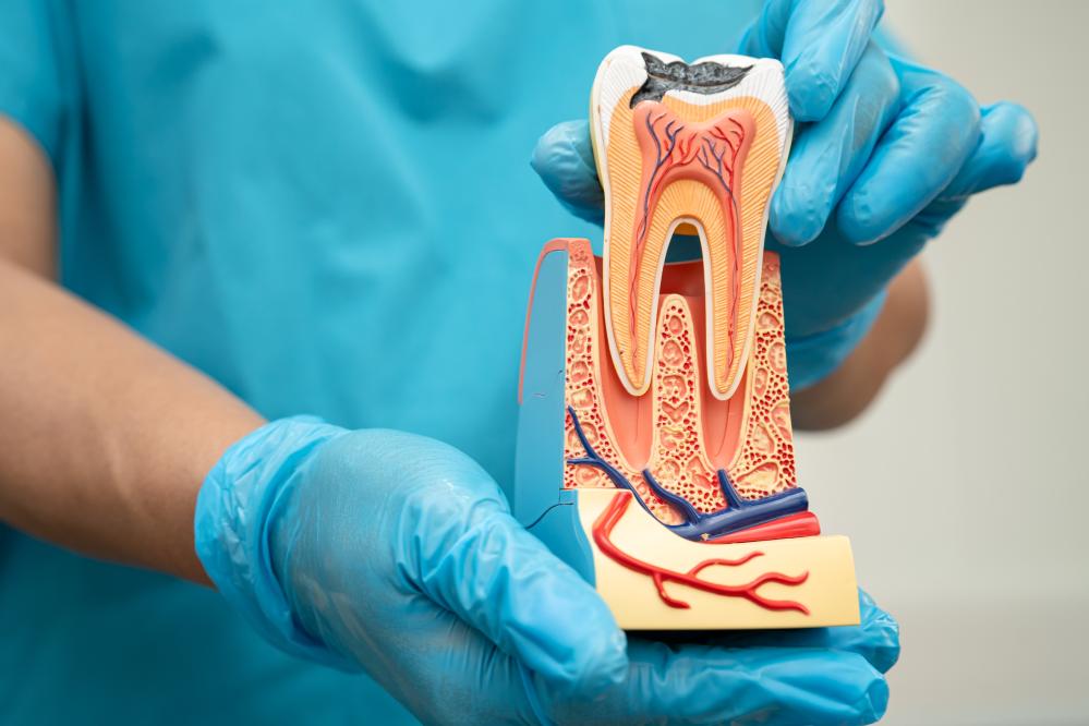 What Happens During a Root Canal Port Coquitlam Procedure?