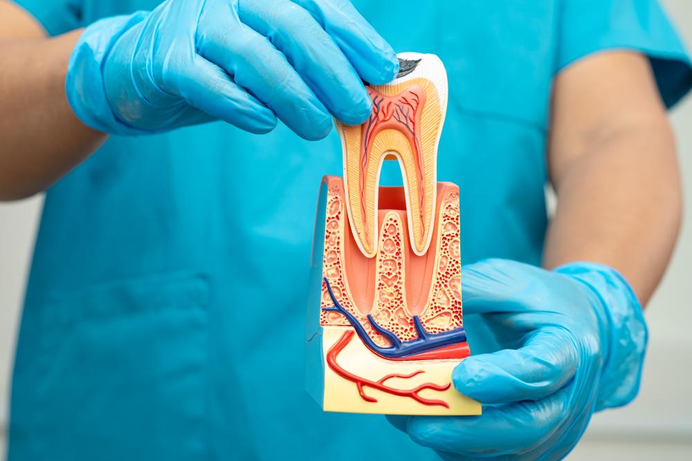 Root Canal Therapy Procedures