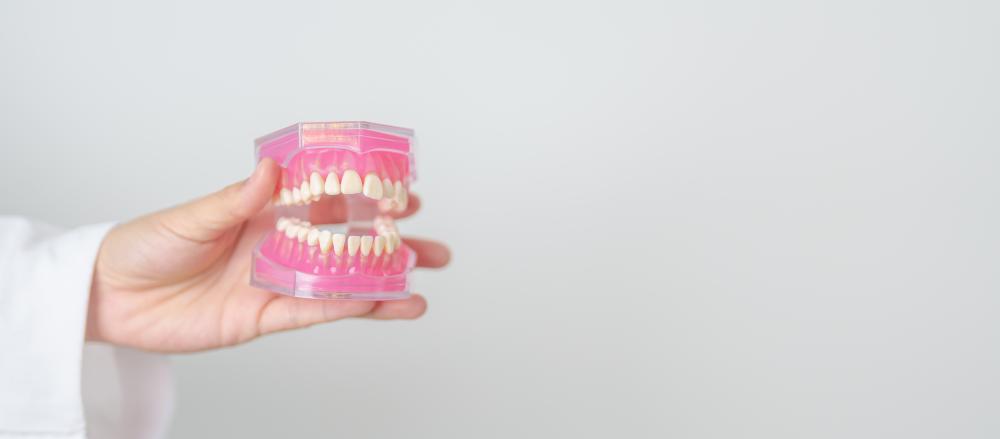 Personal Insights on Dental Cassettes