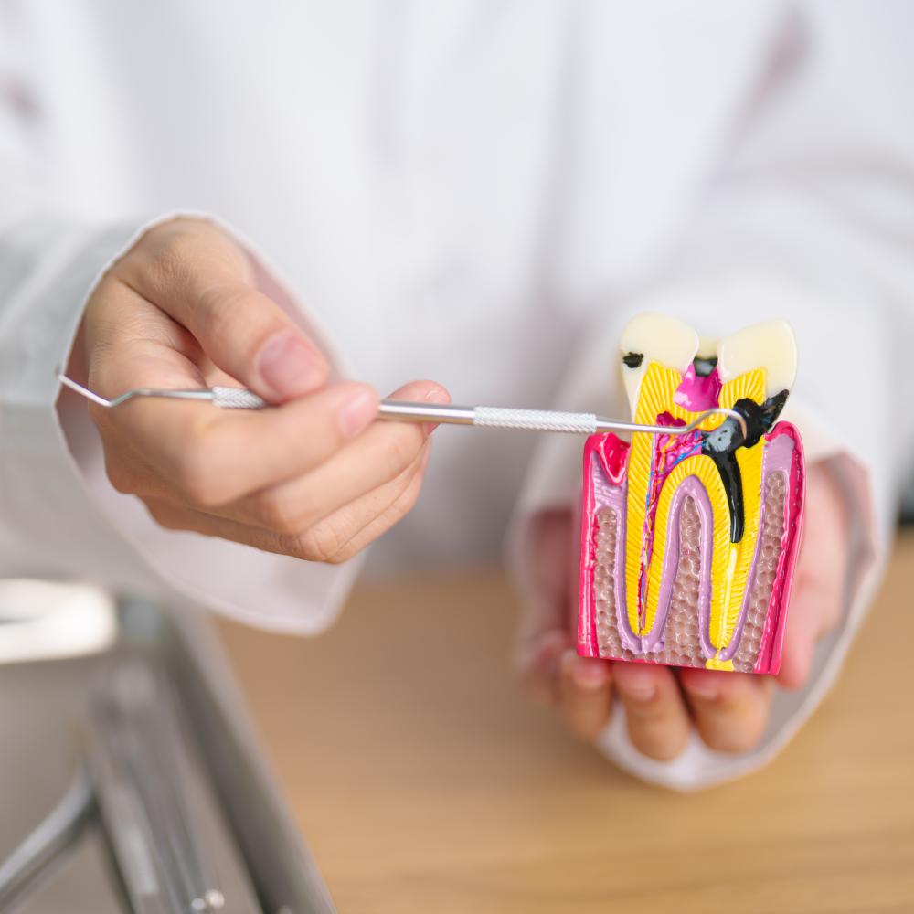 Why Choose Root Canal Therapy?