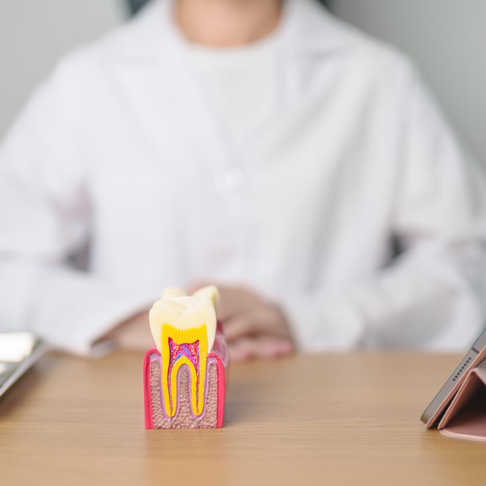 Why Choose Dental Bridges?