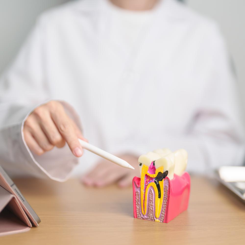 Exploring Types of Dental Fillings