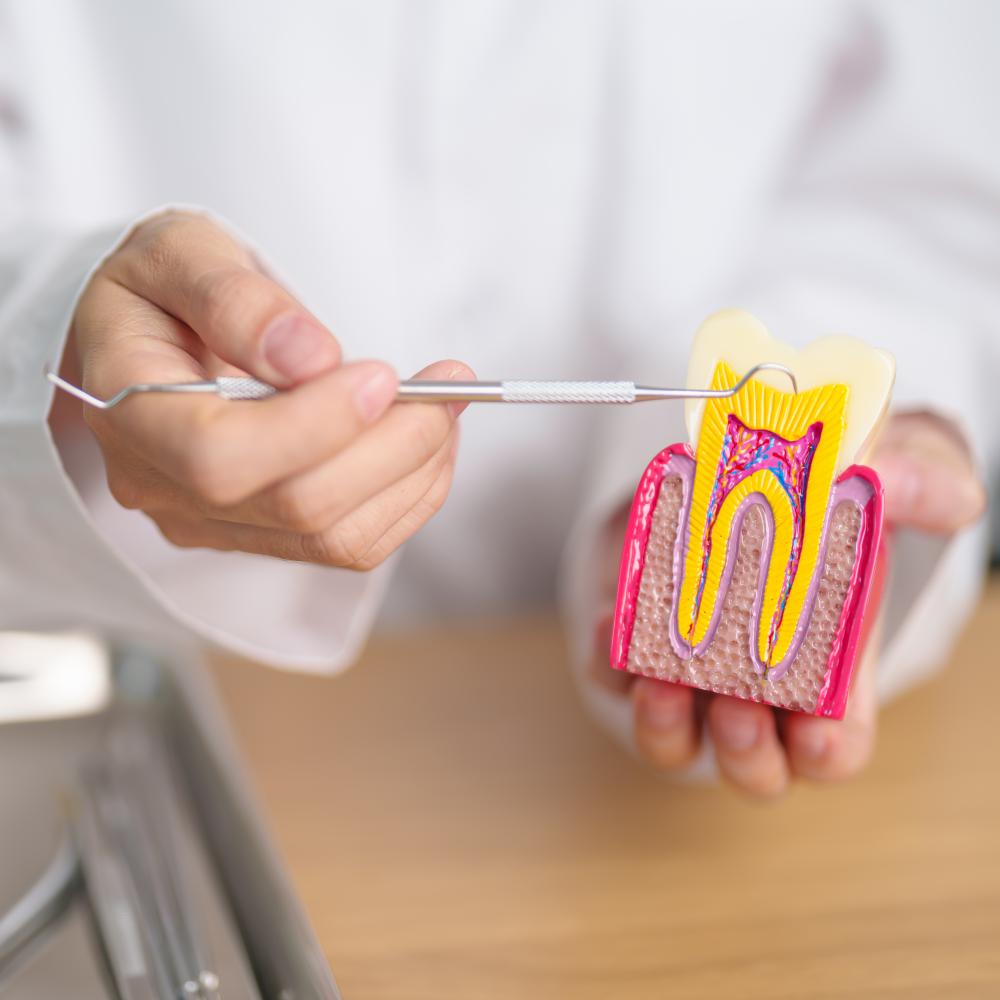 Choosing the Right Dentist for Your North Calgary Root Canal