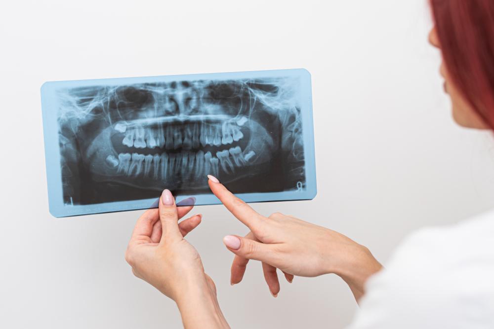 Orthodontist analyzing dental X-rays for patient care