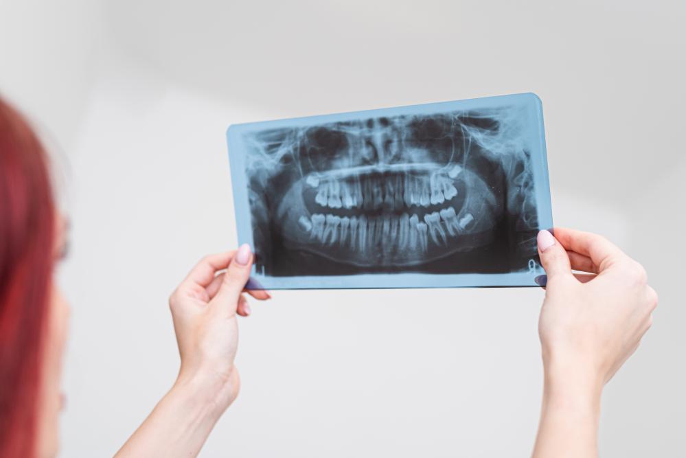 Orthodontist evaluating dental panoramic X-ray for optimized patient treatment plans