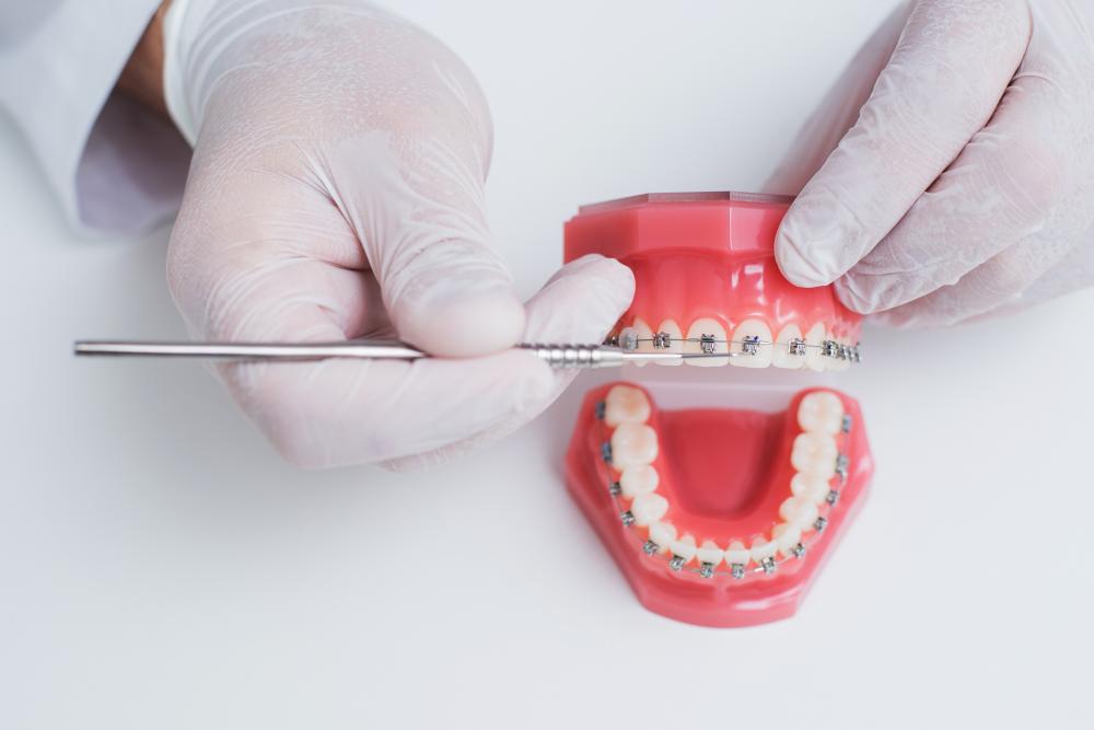 Orthodontist presenting braces system, highlighting dental SEO integration