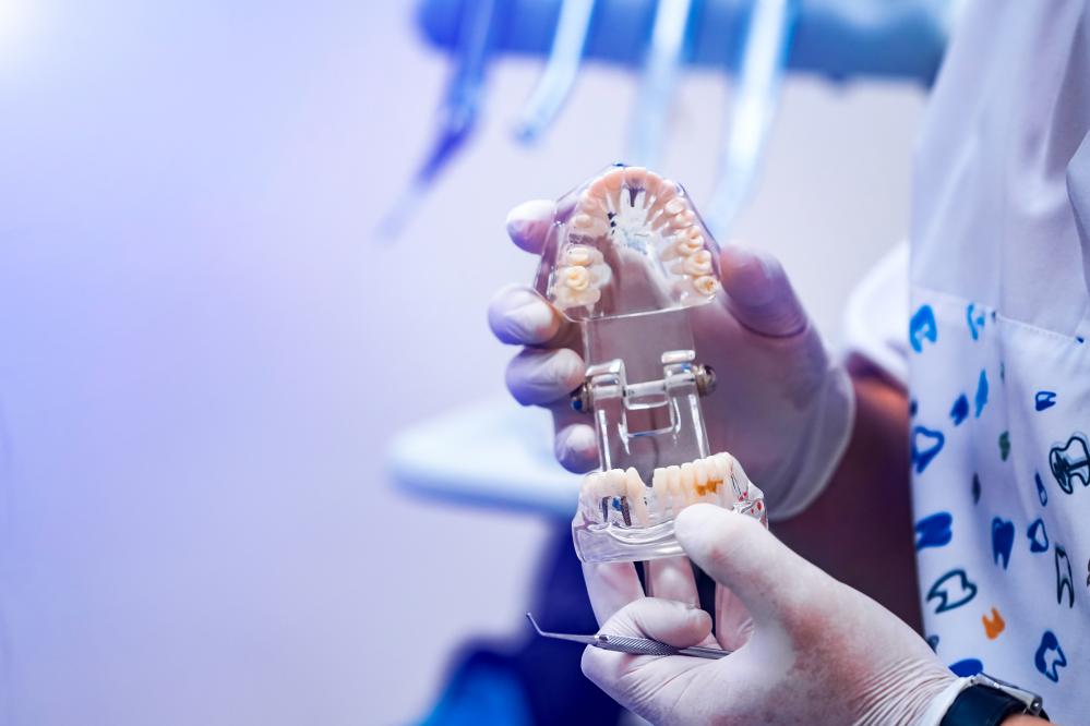 Why Choose Dental Implants