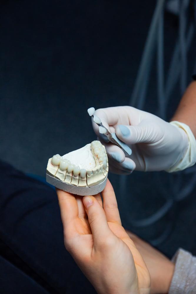 Why Opt for Dental Bridges?