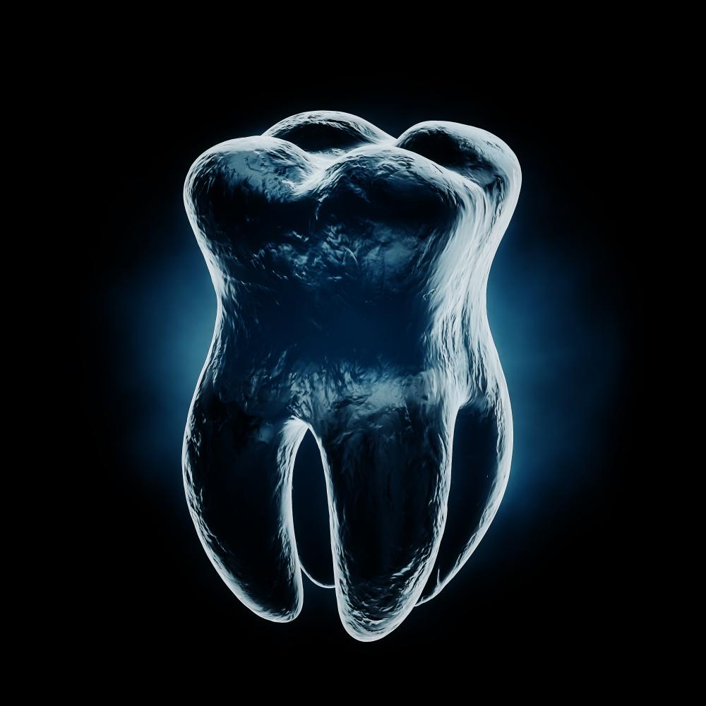 X-ray view of healthy tooth highlighting tooth replacement options