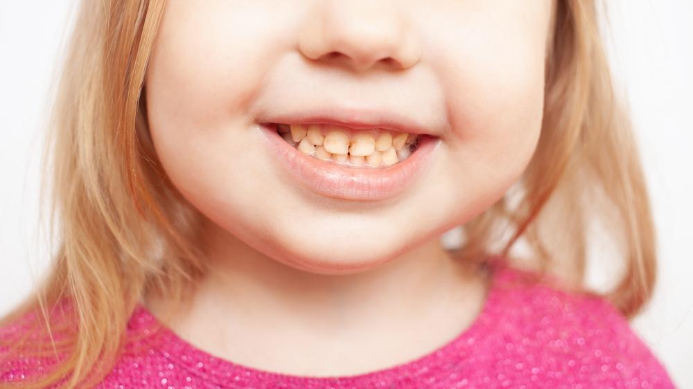 The Importance of Early Dental Visits