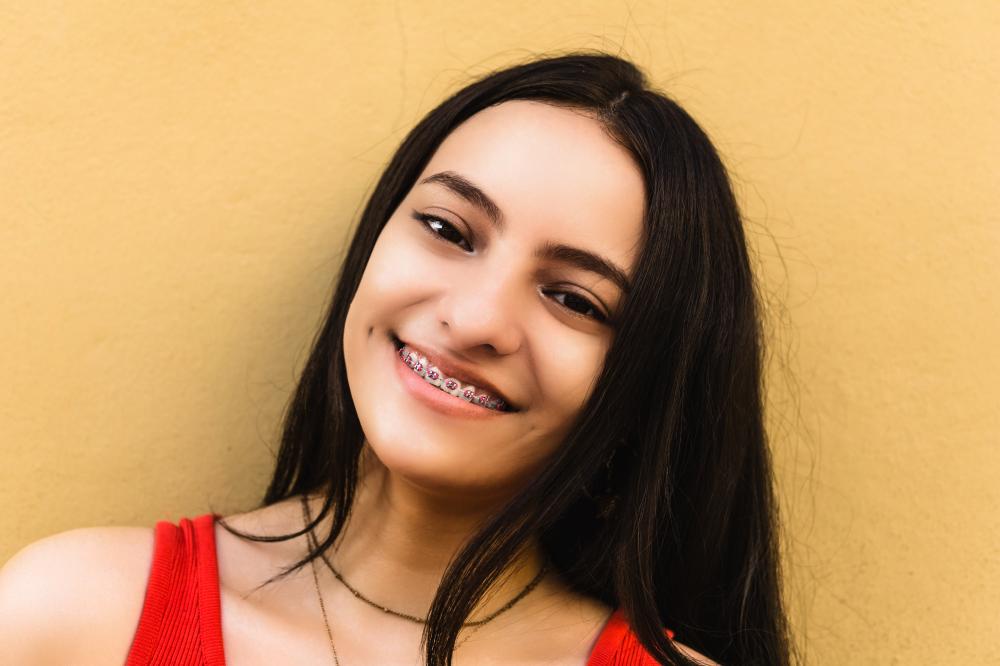 Why Choose Dental Braces in Lake Orion, MI?