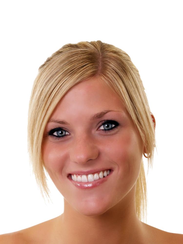 Who Should Consider Dental Veneers White Rock BC?