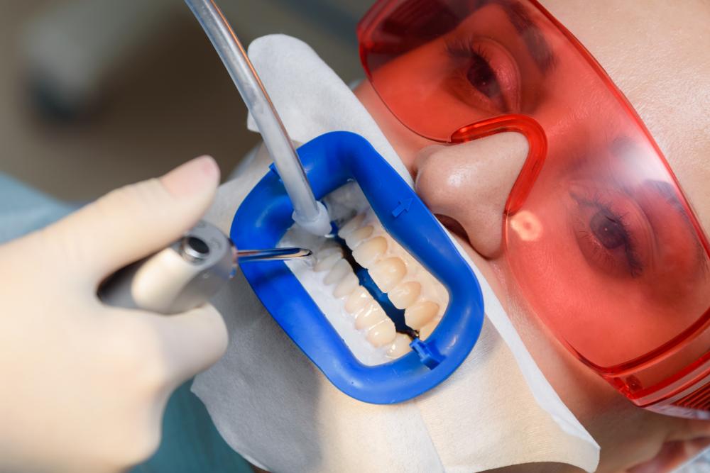 Oral cavity preparation by a periodontist for dental health