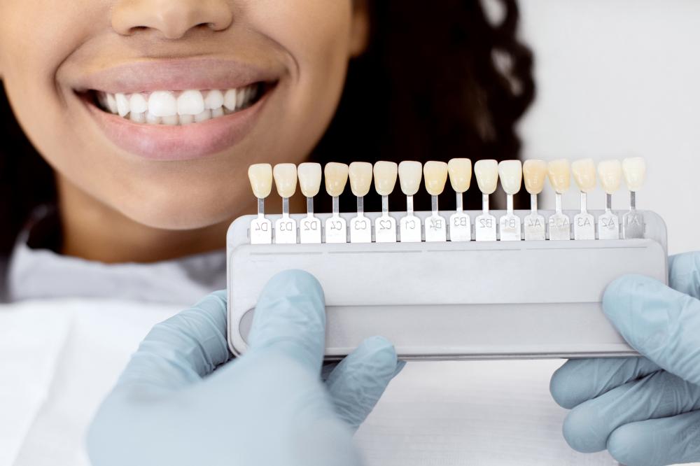 What Makes Dental Implants Appealing?