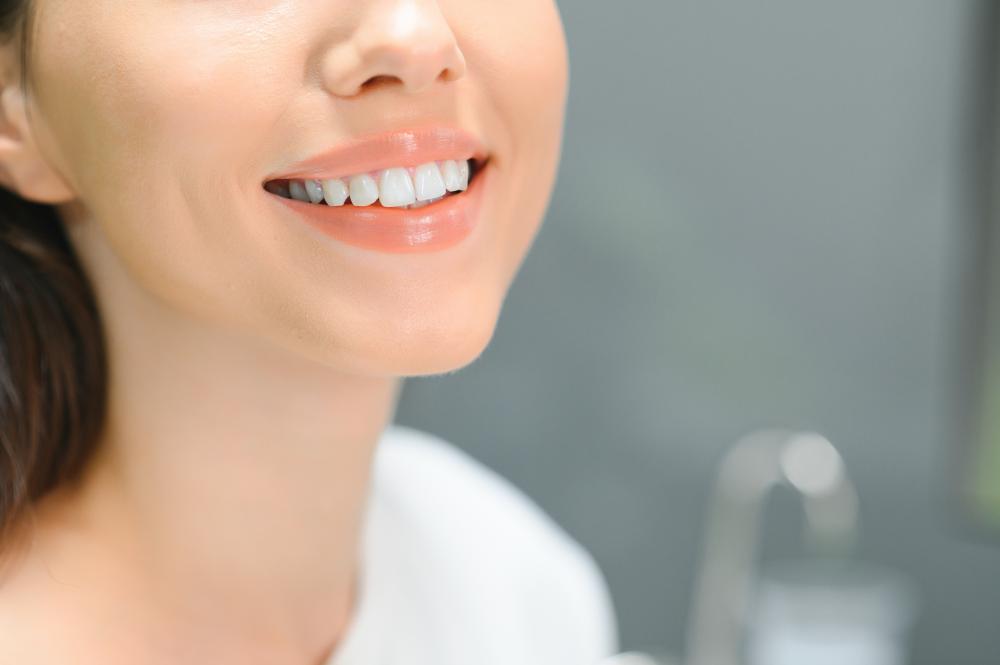 Benefits of Porcelain Veneers