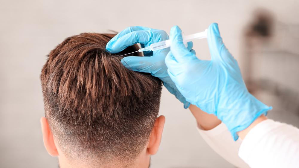How Personal Experience Shaped My Perspective on Stem Cell Therapy For Hair Loss