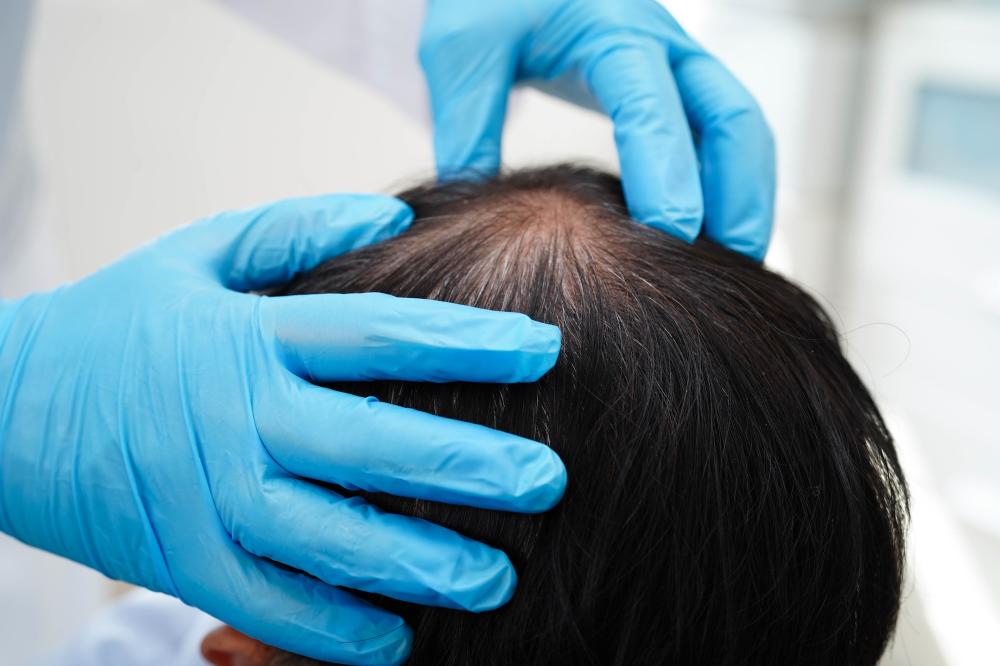 How Do We Address Hair Loss?