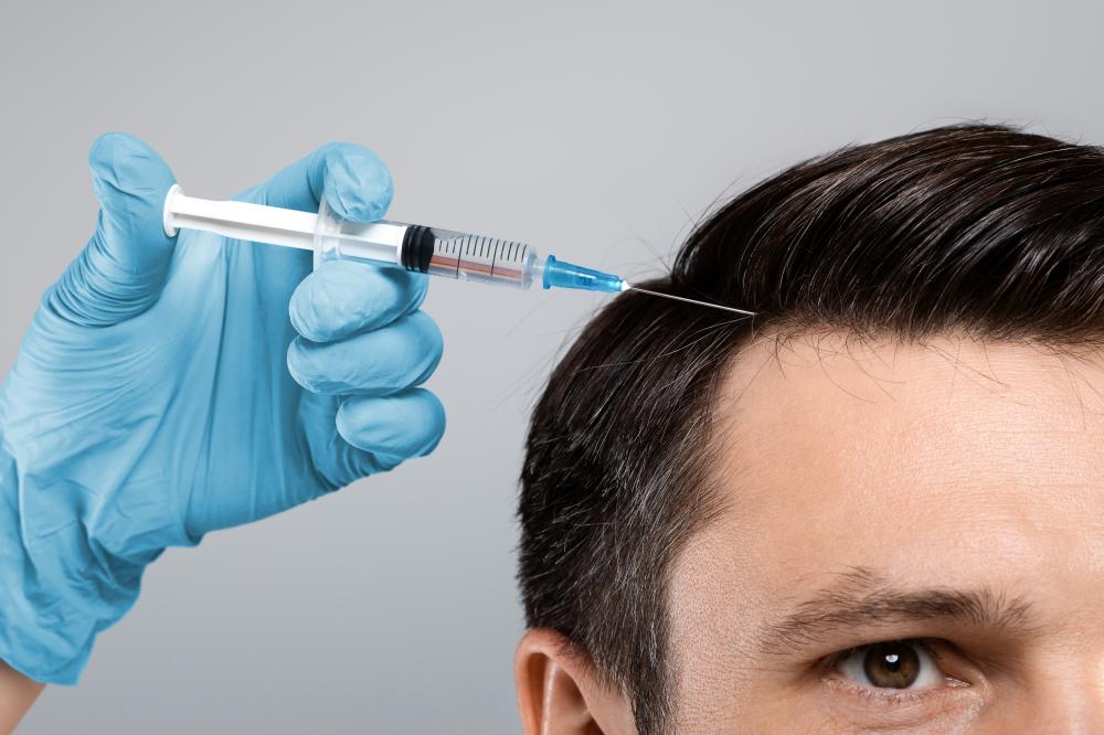 What Techniques Dominate Hair Restoration Tampa?