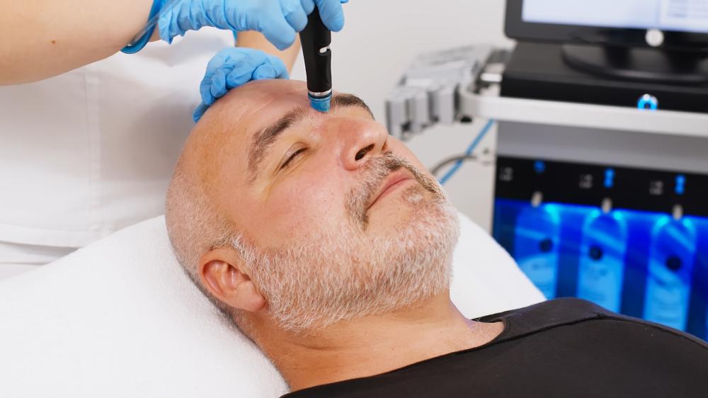 Why Choose Microneedling Carrollwood Fl?