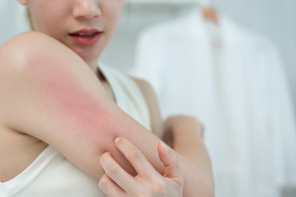 Innovations in Psoriasis Treatment