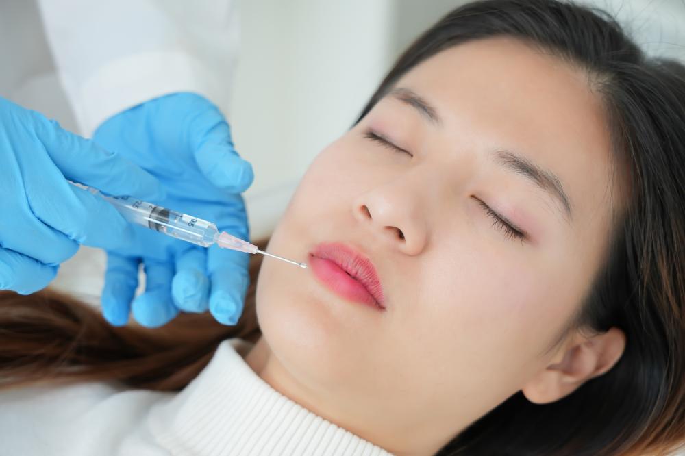 What to Expect During a Lip Filler Treatment