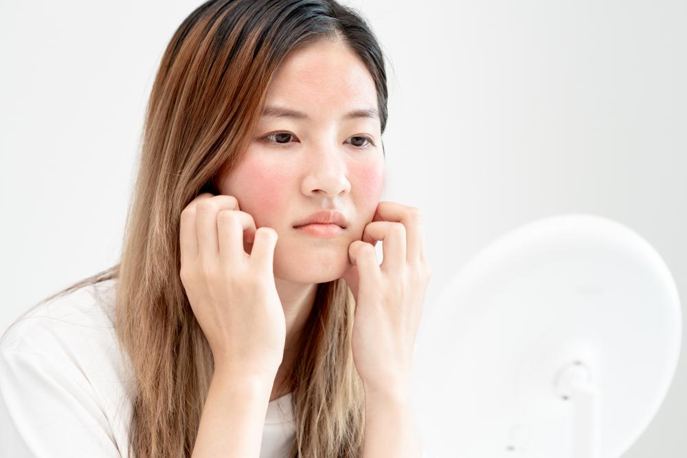 Causes of HormonalAcne